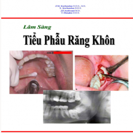 Tiểu phẫu răng khôn.pdf