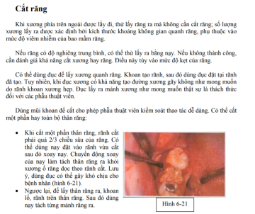 kỹ thuật cắt răng