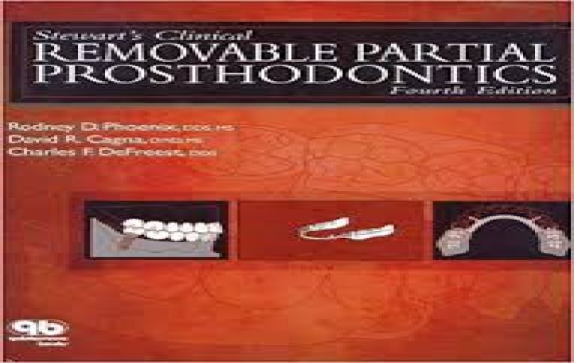 Stewarts Clinical Removable Partial Prosthodontic, 4ed (2008)-download