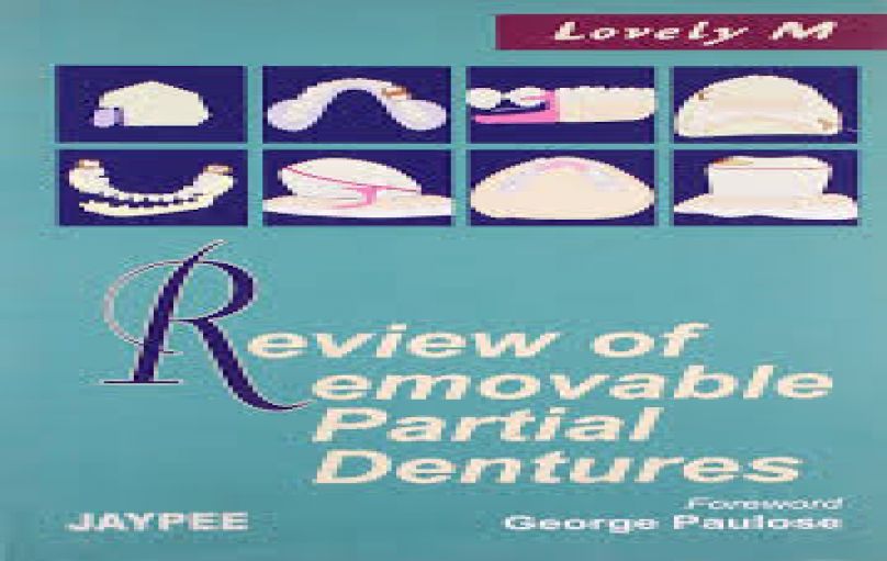 Review of Removable Partial Dentures-1st edition (2005)-download