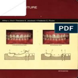 Removable Partial Denture Design, 5th Edition 1999