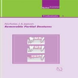 Removable Partial Dentures-QuintEssentials-2004