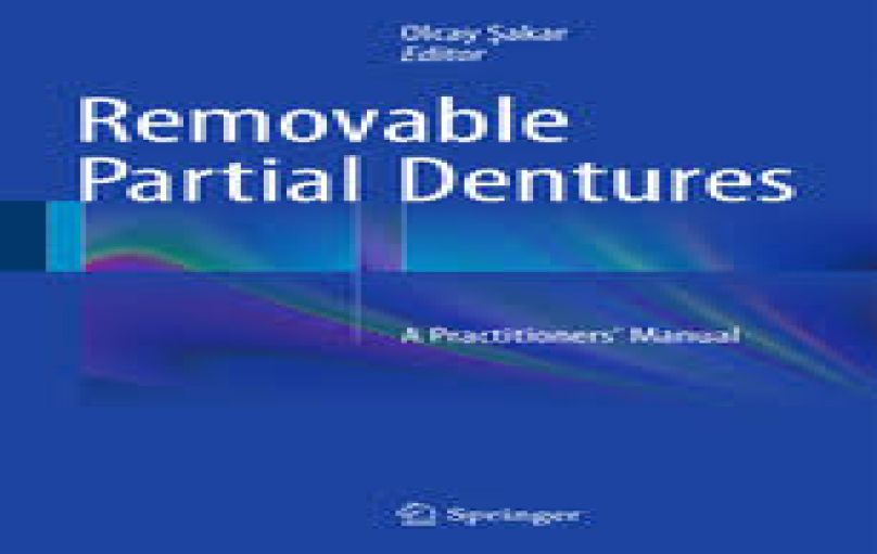 Removable Partial Dentures  A Practitioners’ Manual-download