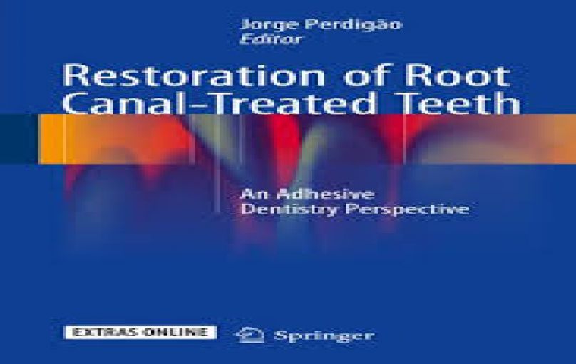 Restoration of Root Canal-Treated Teeth-download