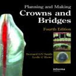 Planning and Making Crowns and Bridges-4th edition (2006)