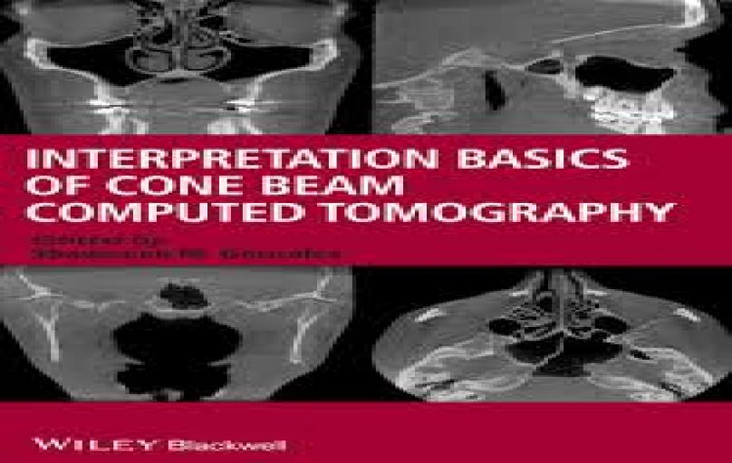 Interpretation Basics of Cone Beam Computed Tomography-download