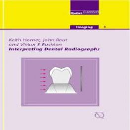 Interpreting Dental Radiographs - QuintEssentials-2002
