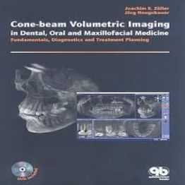 Cone-beam Volumetric Imaging in Dental, Oral and Maxillofacial Medicine