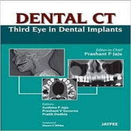 Dental CT- Third Eye in Dental Implants (2013)
