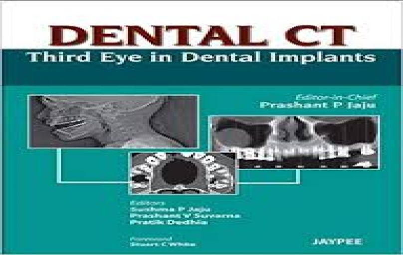 Dental CT- Third Eye in Dental Implants (2013)-download