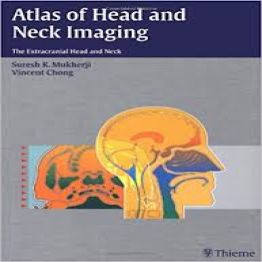 Atlas of head and neck imaging