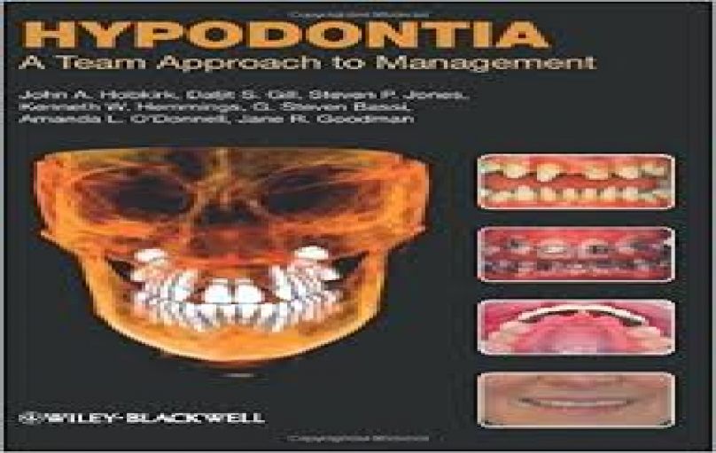 Hypodontia- A Team Approach to Management-1st-edition (2011)-download