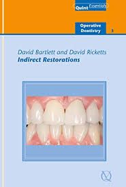 Indirect Restorations (Quintessentials of Dental Practice)