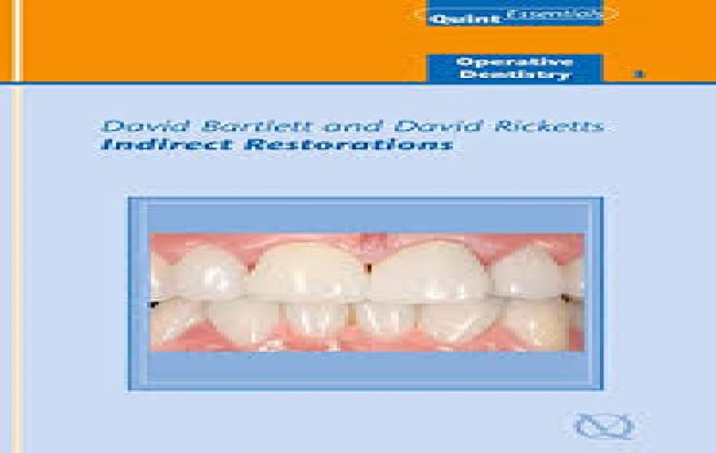Indirect Restorations (Quintessentials of Dental Practice)-download