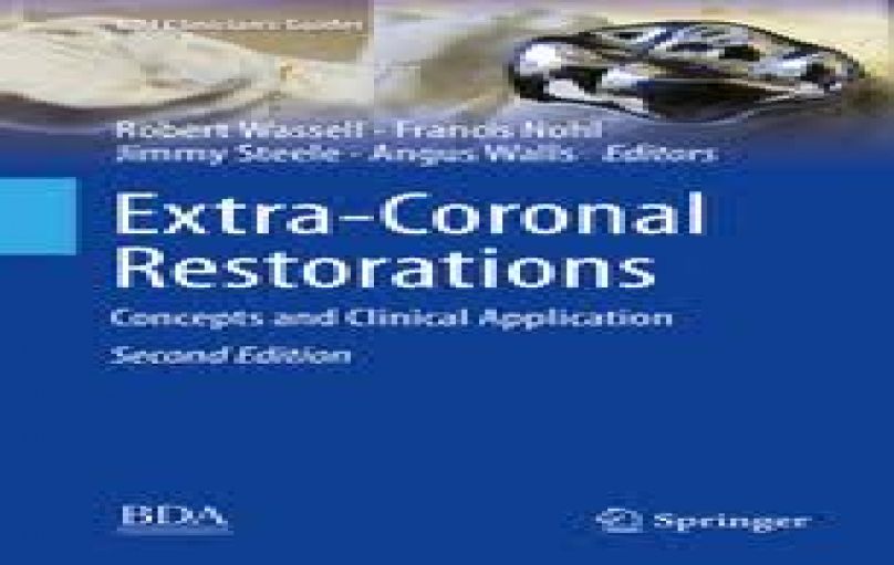 Extra-Coronal Restorations-Concepts and Clinical Application-download