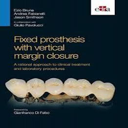 Fixed Prosthesis With Vertical Margin Closure-2016