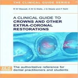 A Clinical Guide to Crowns and Other Extra-coronal Restoration - BDJ