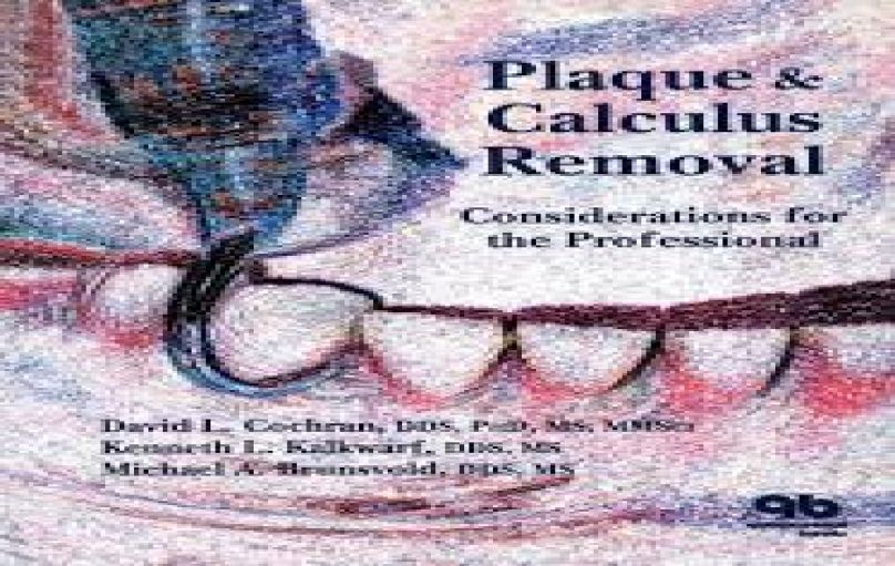 Plaque and Calculus Removal Considerations for The Professional-download