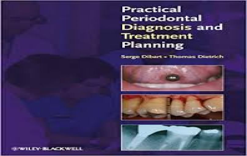 Practical Periodontal Diagnosis and Treatment Planning (2010)-download