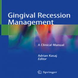 Gingival Recession Management-2018