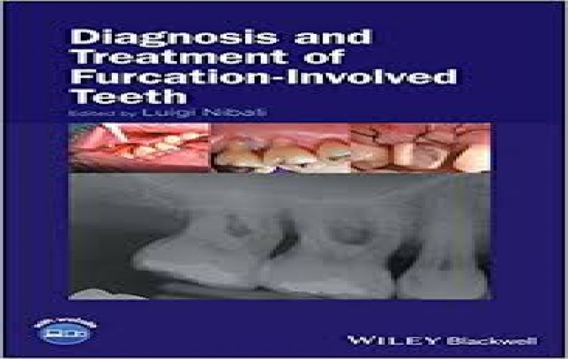 Diagnosis and Treatment of Furcation-Involved Teeth-download