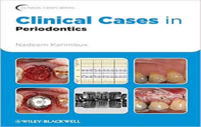 Clinical Cases in Periodontics-1st-edition (2011)-download