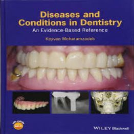 Diseases and Conditions in Dentistry An Evidence-Based Reference