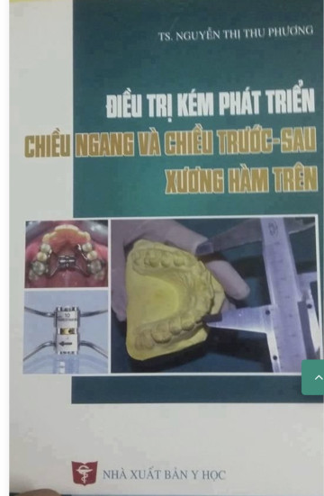 CHƯƠNG 4: KÉM PHÁT TRIỂN CHIỀU TRƯỚC SAU XƯƠNG HÀM TRÊN.N