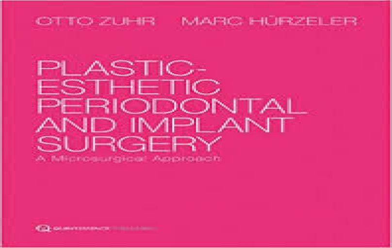 PLASTIC-ESTHETIC PERIODONTAL AND IMPLANT SURGERY-download
