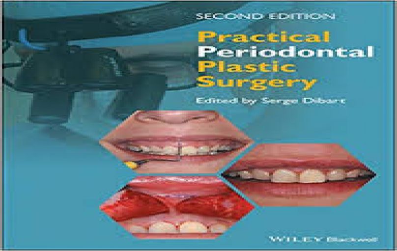 PRACTICAL PERIODONTAL PLASTIC SURGERY, 2nd edition-download