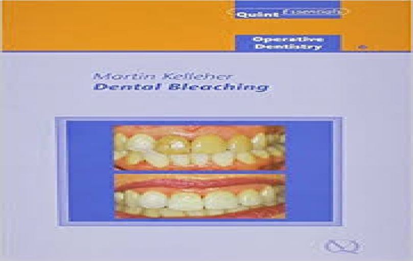 Dental Bleaching-Operative Dentistry 6, QuintEssentials 2008-download