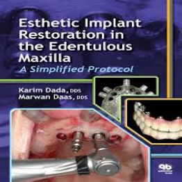 Esthetic Implant Restoration in the Edentulous Maxilla A Simplif