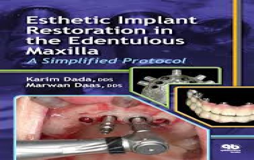 Esthetic Implant Restoration in the Edentulous Maxilla A Simplif-download