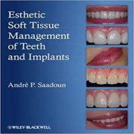 Esthetic Soft Tissue Management of Teeth and Implants-2nd-edition(2012)