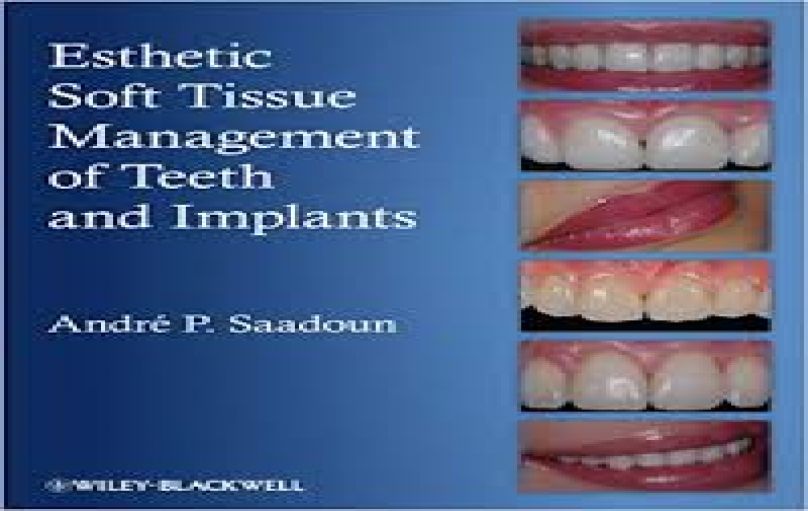 Esthetic Soft Tissue Management of Teeth and Implants-2nd-edition(2012)-download