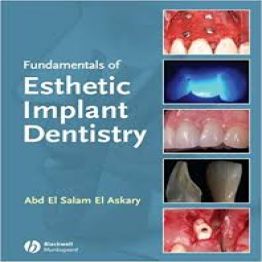 Fundamentals of Esthetic Implant Dentistry-2nd edition