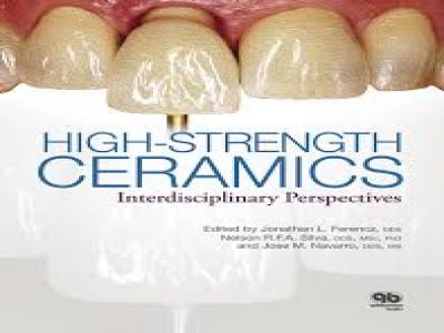 High-Strength Ceramics Interdisciplinary Perspectives