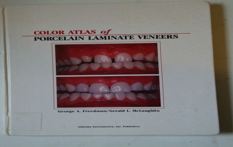 Color atlas of Laminate porcelain Veneers-1990-download
