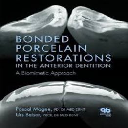 Bonded Porcelain Restorations - Pascal Magne