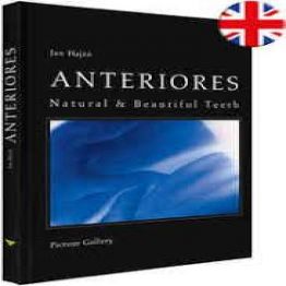 Anteriors Natural & Beautiful Teeth