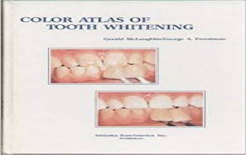 Color Atlas of Tooth Whitening-1991-download