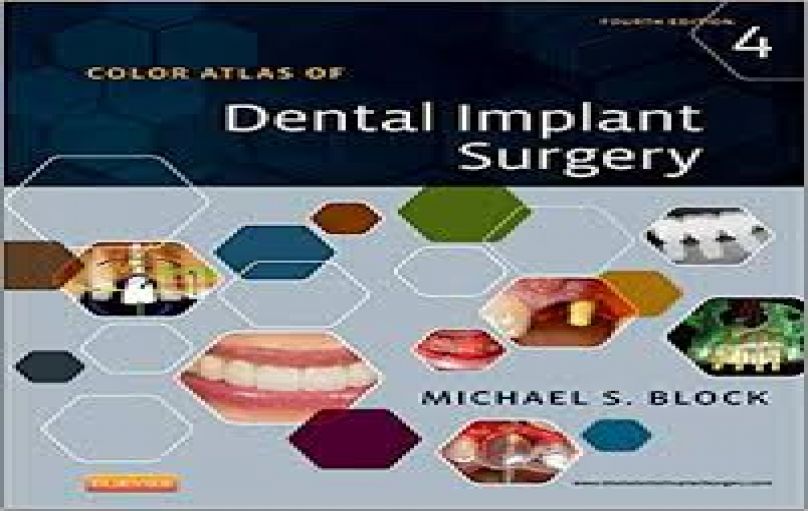 Color Atlas of Dental Implant Surgery 4th edition (2015)-download
