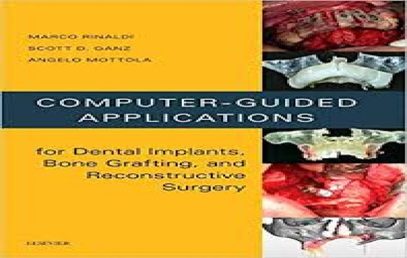 Computer-Guided Applications for Dental Implants_Bone-Grafting-and-Reconstructive-Surgery-download