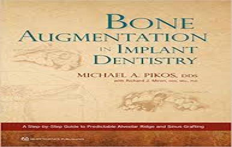 Bone Augmentation in Implant Dentistry-A Step-by-Step Guide-2019-download