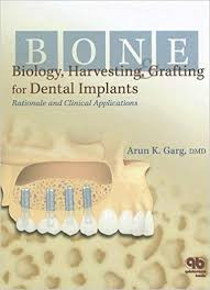 Bone Biology, Harvesting, and Grafting For Dental Implants