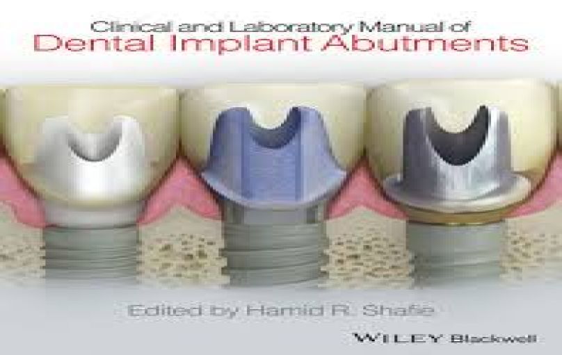 Clinical and Laboratory Manual of Dental Implant Abutment-download