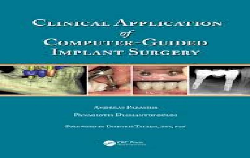 Clinical Application of Computer Guided Implant Surgery-download
