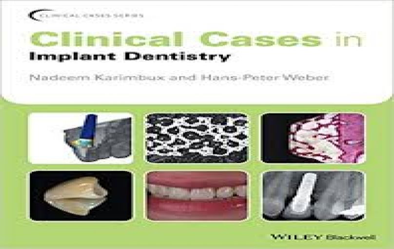 Clinical Cases in Implant Dentistry-download