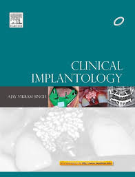 Clinical Implantology 1st-edition
