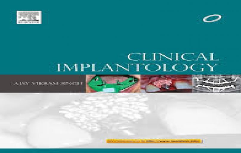 Clinical Implantology 1st-edition-download